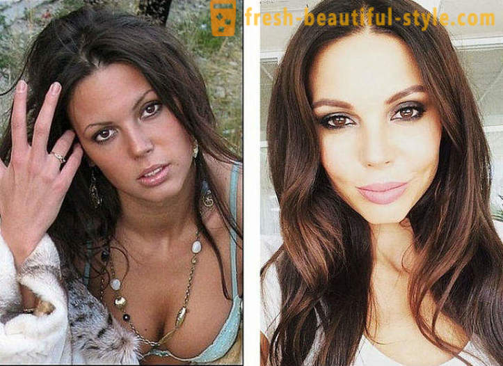 10 Russian beauties before and after plastic