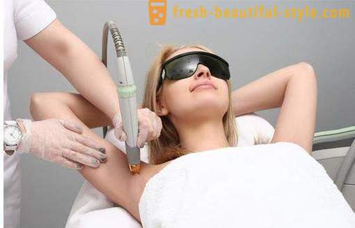 Laser hair removal 