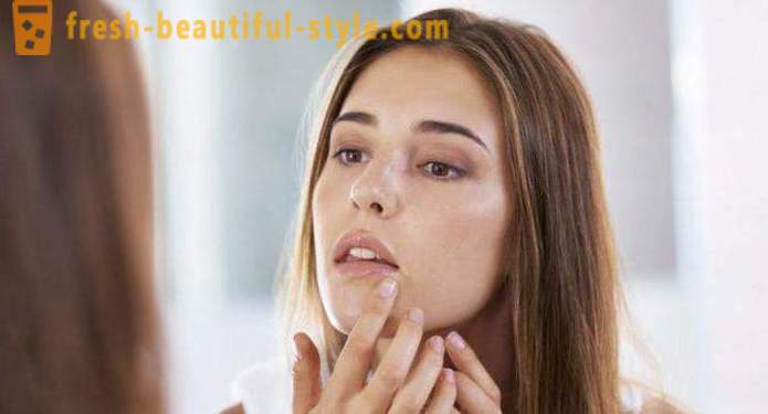 Why do many people have pimples on your face? Causes and methods of treatment