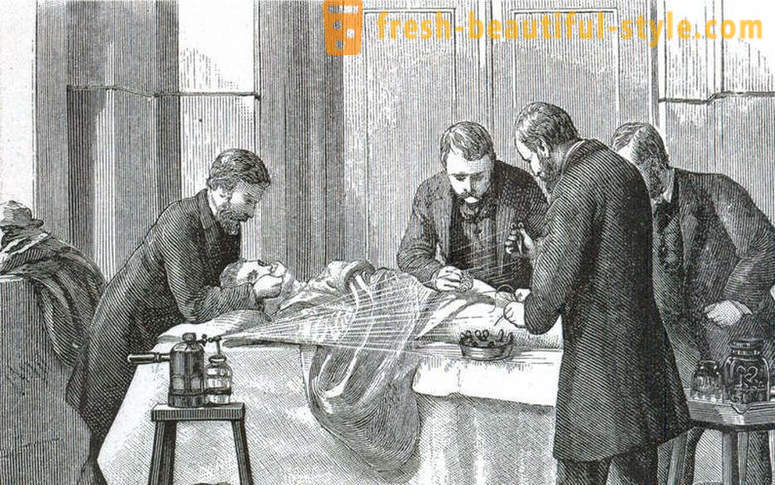 Shocking facts about the Victorian surgery