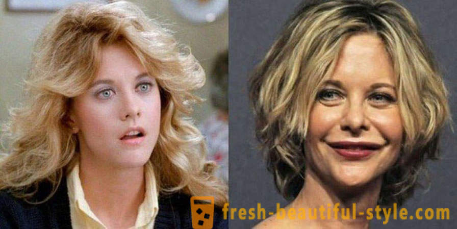 15 celebrities, finished badly with Botox