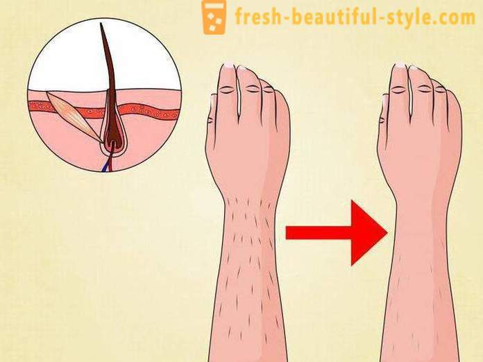How long does laser hair removal? Reviews of the effectiveness of