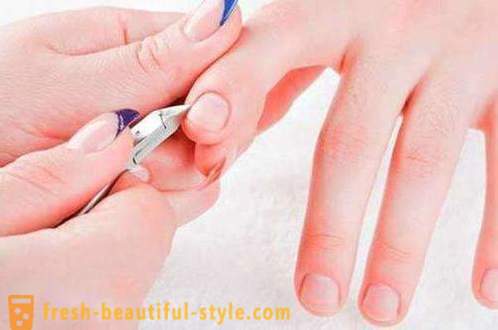 How to get rid of burrs on the fingers? The causes of and treatments