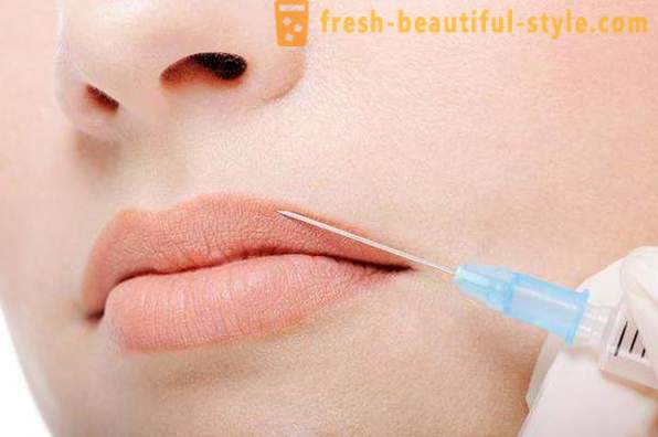How to clean the wrinkles on the upper lip in cosmetology?