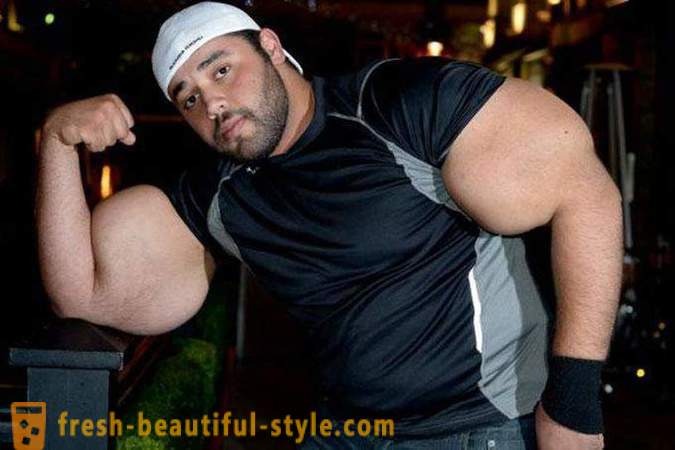 The biggest biceps in the world belongs to whom?