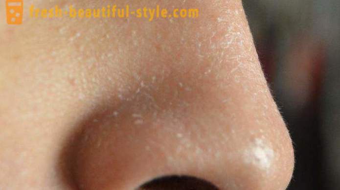 Why scaly skin on the face? Problem facial skin