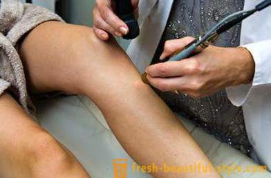 Laser Hair Removal: contraindications and consequences. Laser Hair Removal: contraindications in pregnancy