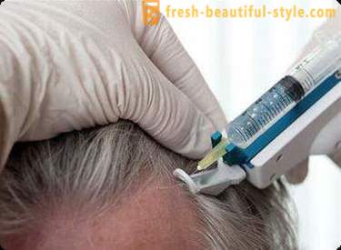 Mesotherapy for hair: Makeup tools and contraindications