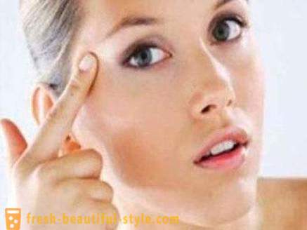 How to remove wrinkles around the eyes? Cream, mask of wrinkles around the eyes: reviews