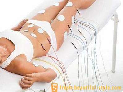 What is myostimulation. Reviews and scope