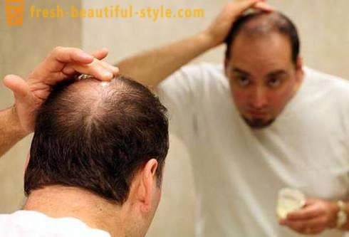 Much hair fall out. Causes and Treatment
