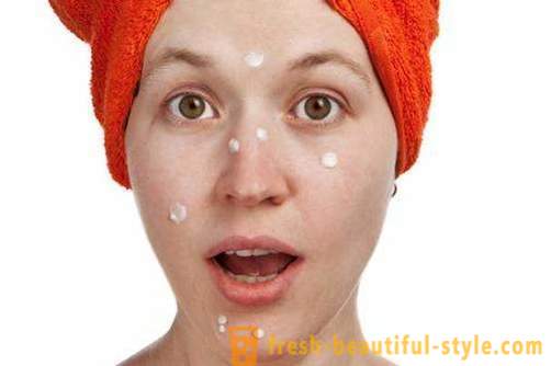 How to remove pimples: Tips