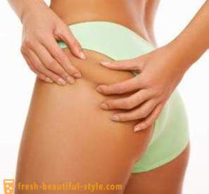 Fighting cellulite at home: cosmetics, body wraps, massages